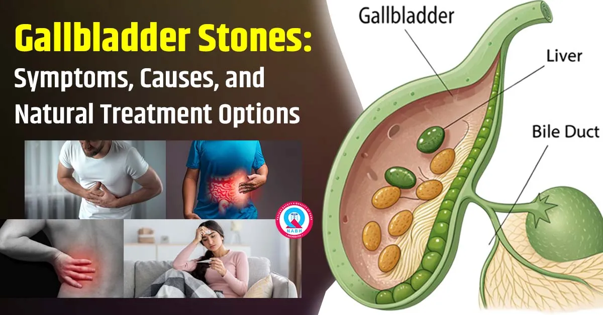 gallbladder-stones-symptoms-causes-and-natural-treatment